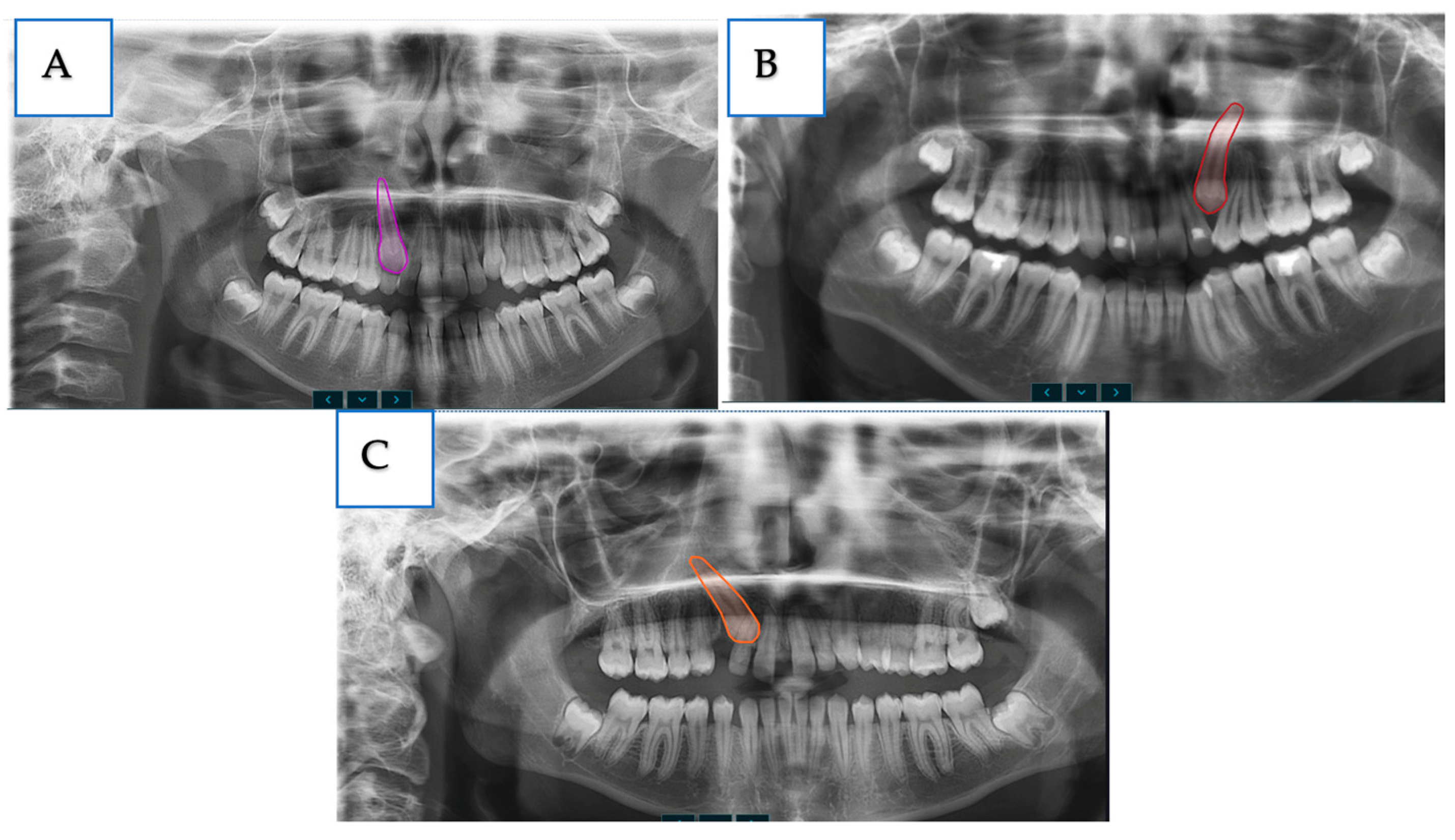 Diagnostics 16 03167 g002 Diagnostics 16 03167 g002