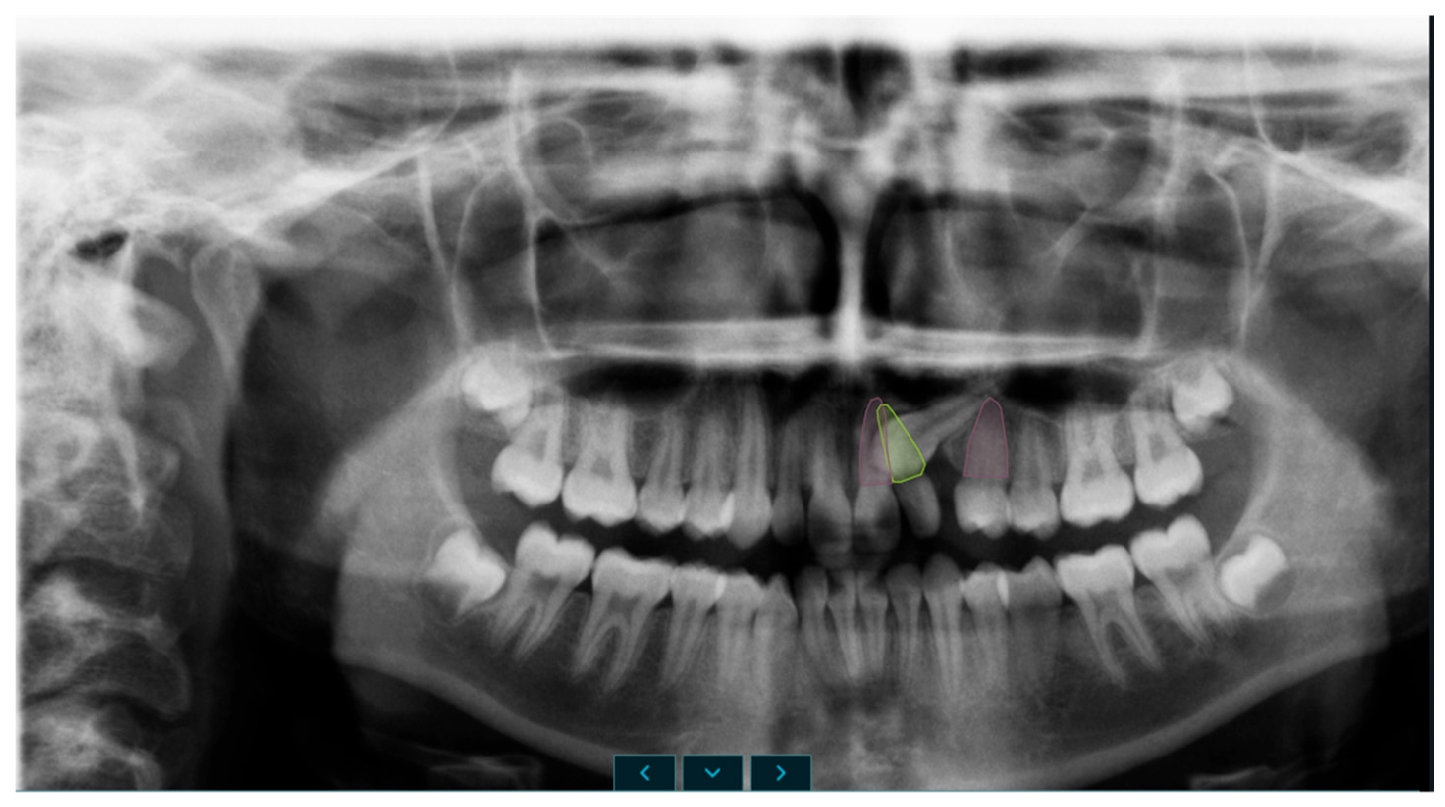 Diagnostics 16 03167 g004 Diagnostics 16 03167 g004