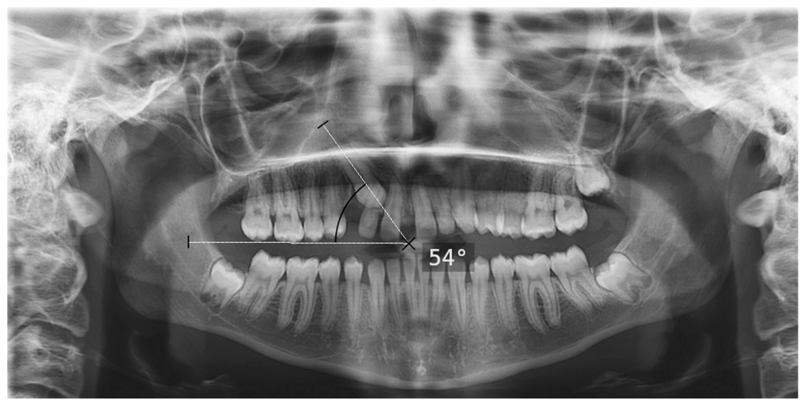 Diagnostics 16 03167 g005 Diagnostics 16 03167 g005