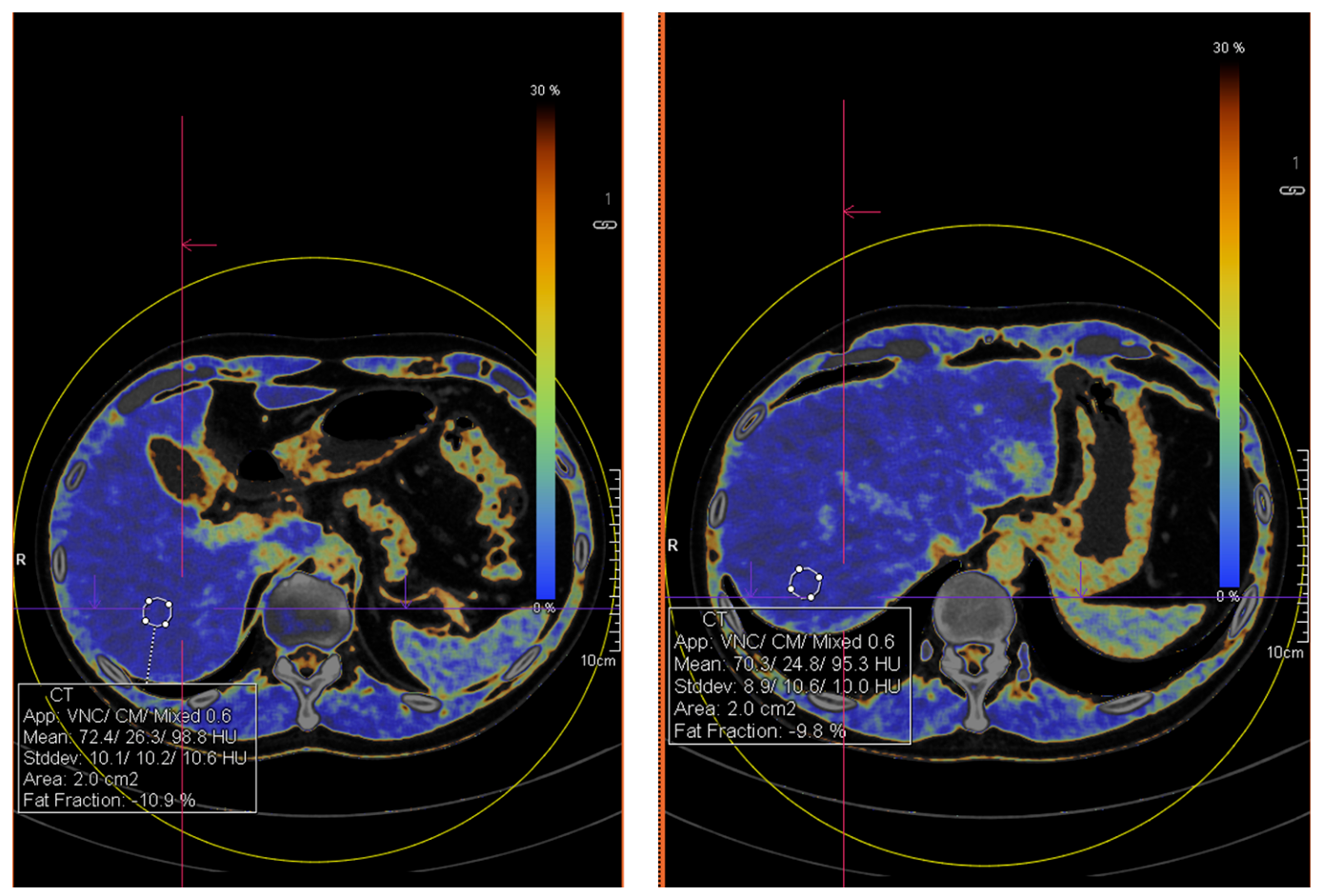 Diagnostics 16 03260 g002 Diagnostics 16 03260 g002