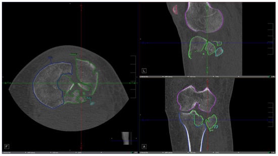 Diagnostics 16 03325 g002