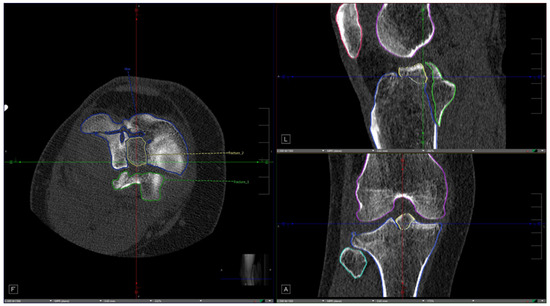 Diagnostics 16 03325 g003