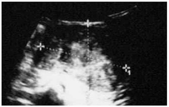 Diagnostics 16 03376 g001