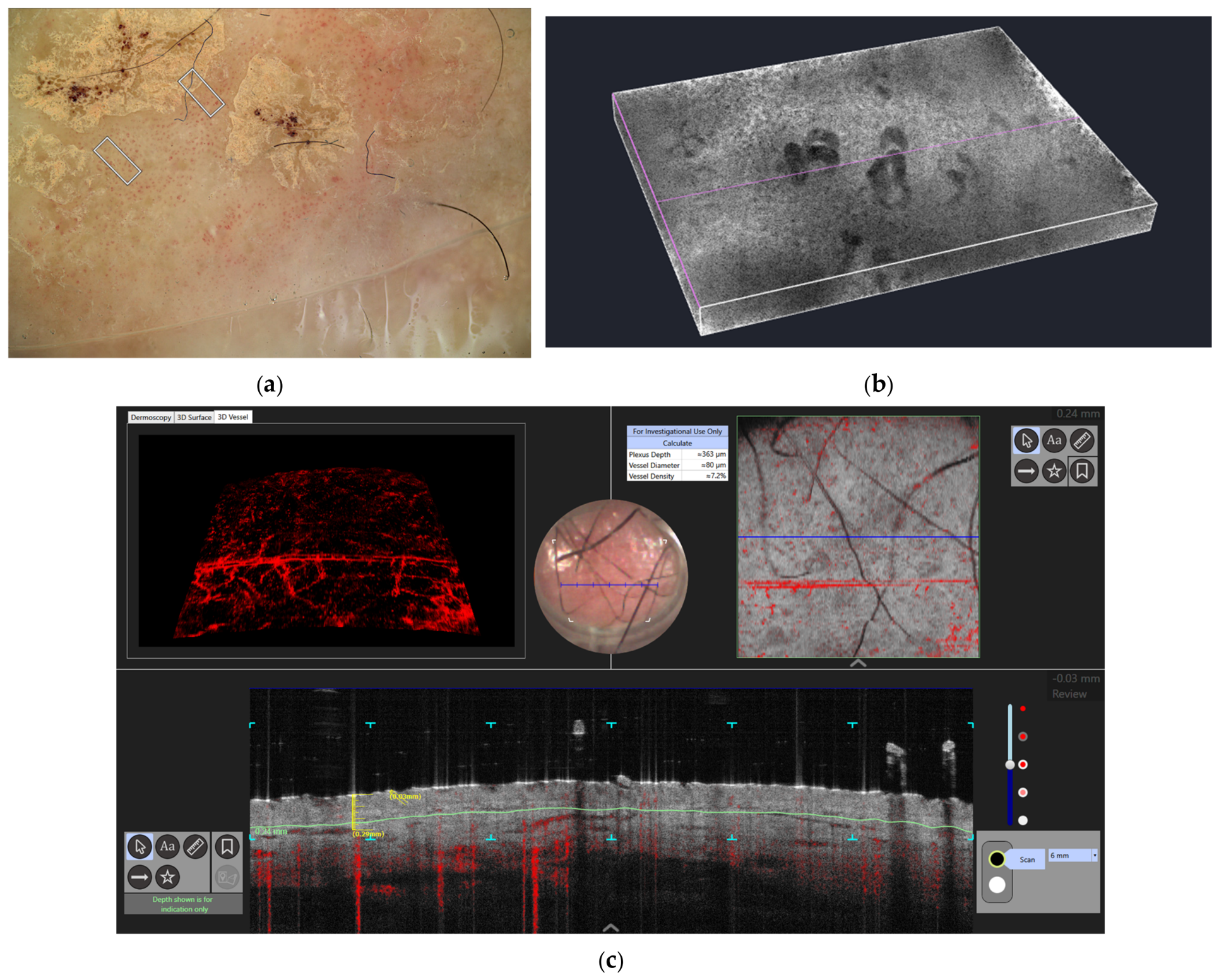 Diagnostics 16 03498 g004 Diagnostics 16 03498 g004