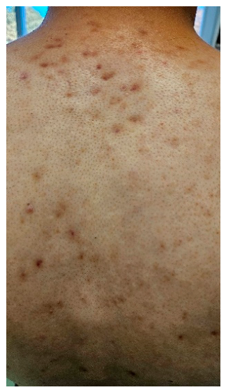 Diagnostics 16 03499 g003 Diagnostics 16 03499 g003