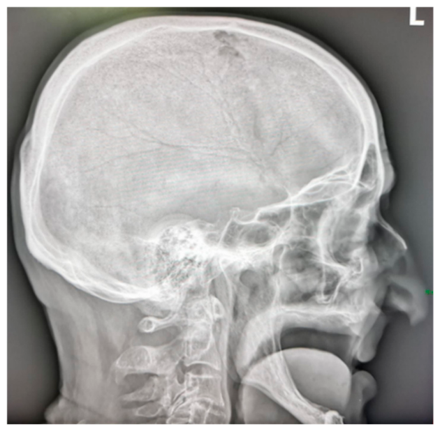 Diagnostics 16 03499 g006 Diagnostics 16 03499 g006