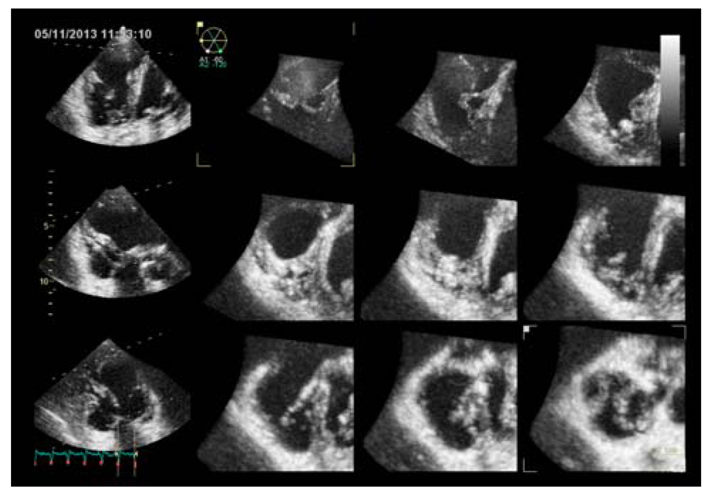 Diseases 02 00274 g005 1024