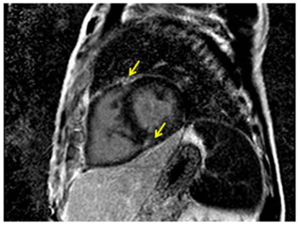 Diseases 02 00274 g007 1024