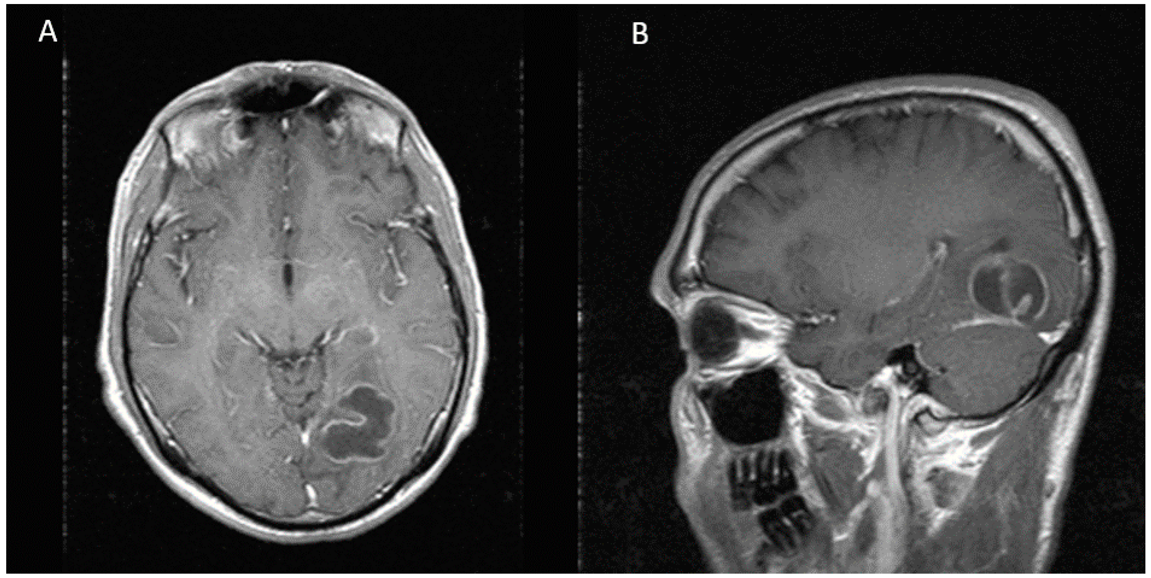 Diseases 05 00026 g001