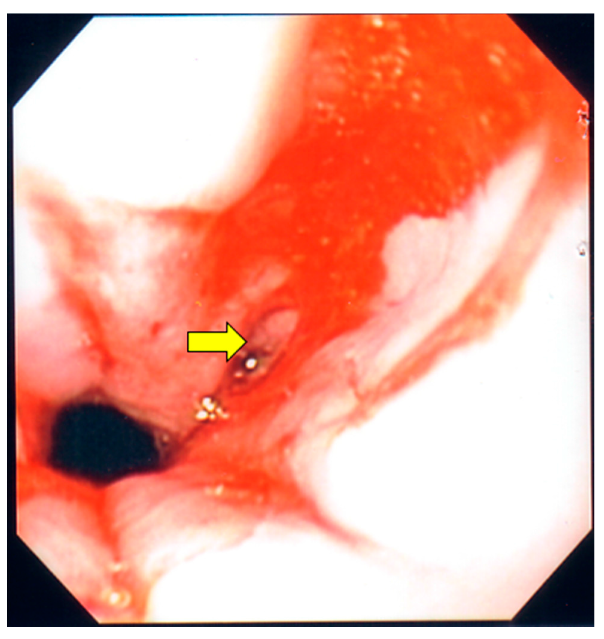 Diseases 05 00030 g002