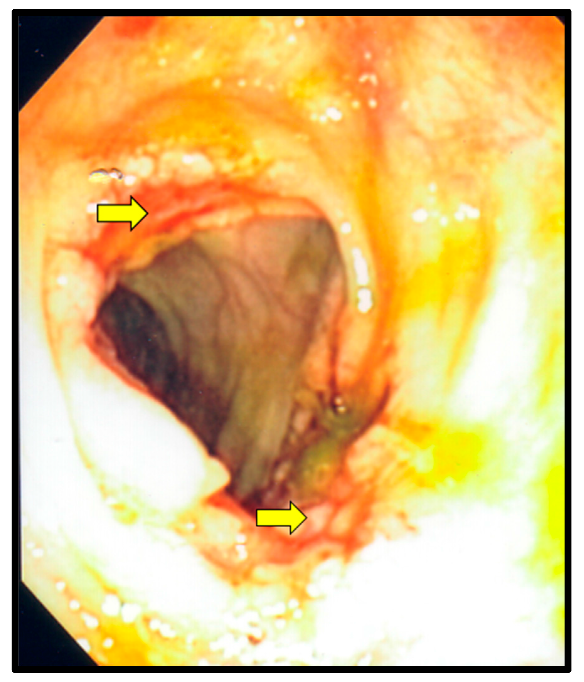 Diseases 05 00030 g003