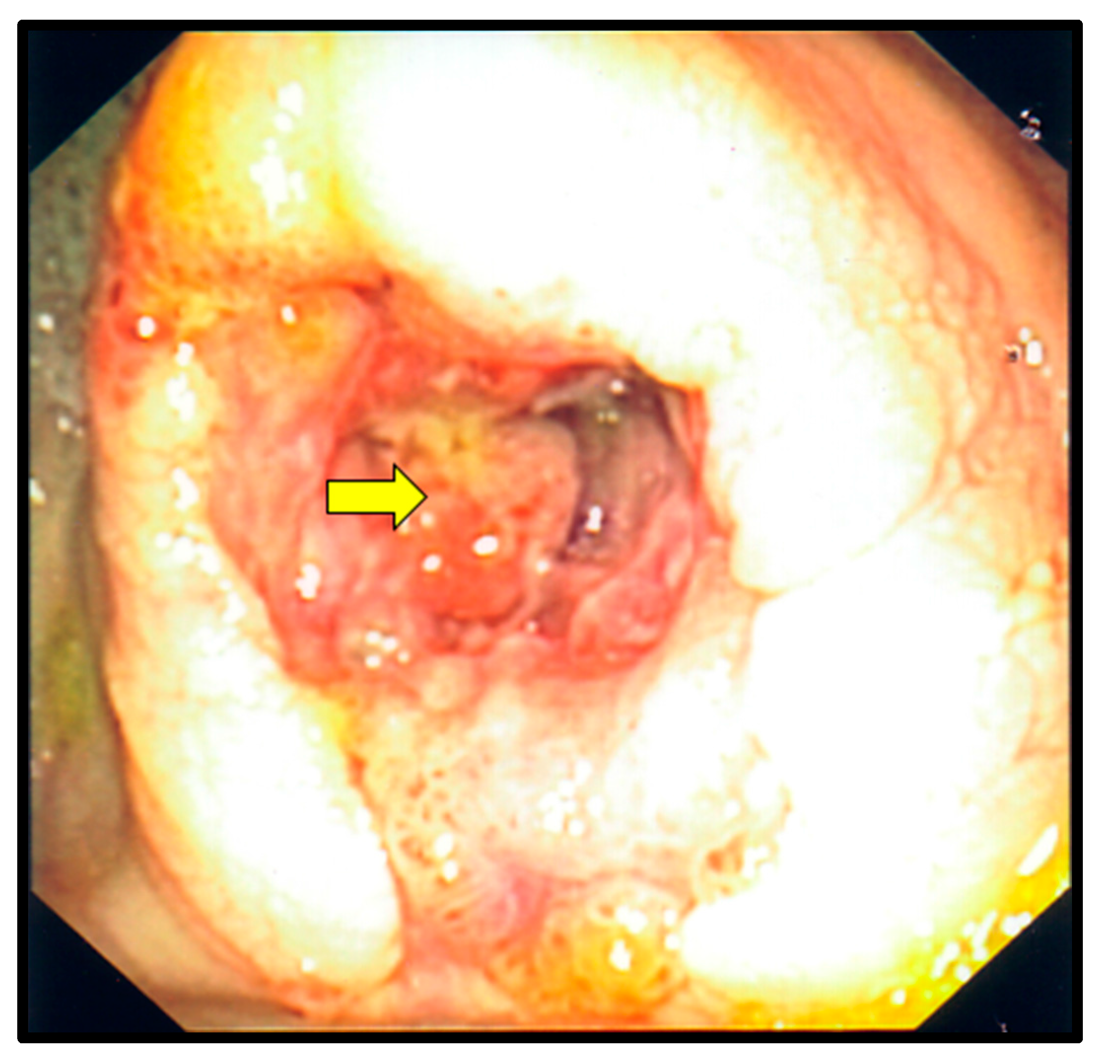 Diseases 05 00030 g004
