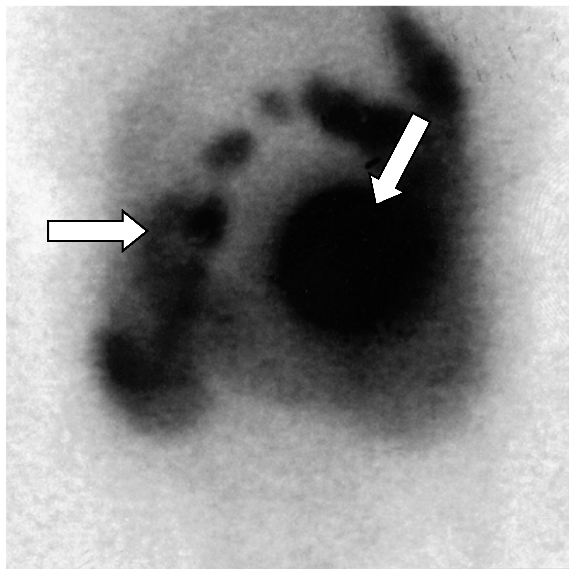 Diseases 06 00008 g005