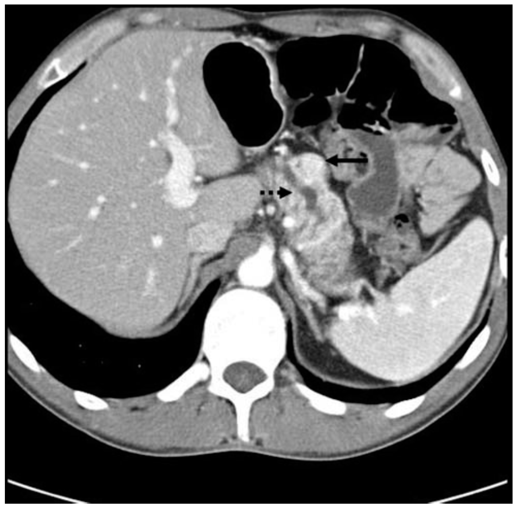 Diseases 06 00008 g006