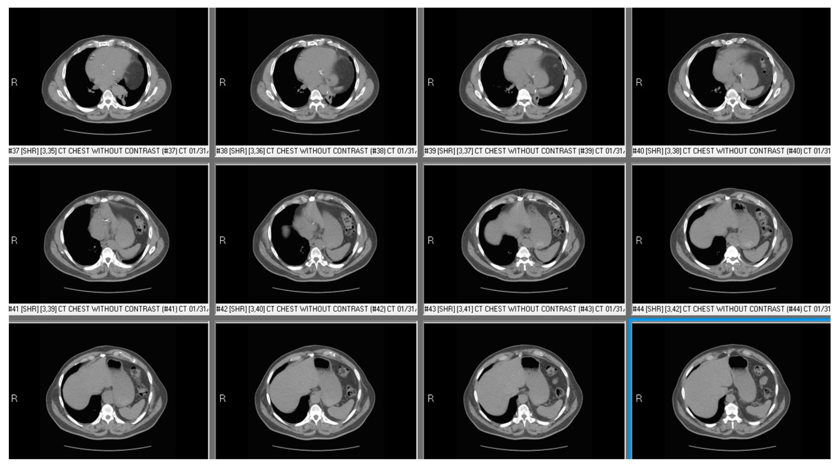 Diseases 06 00016 g004