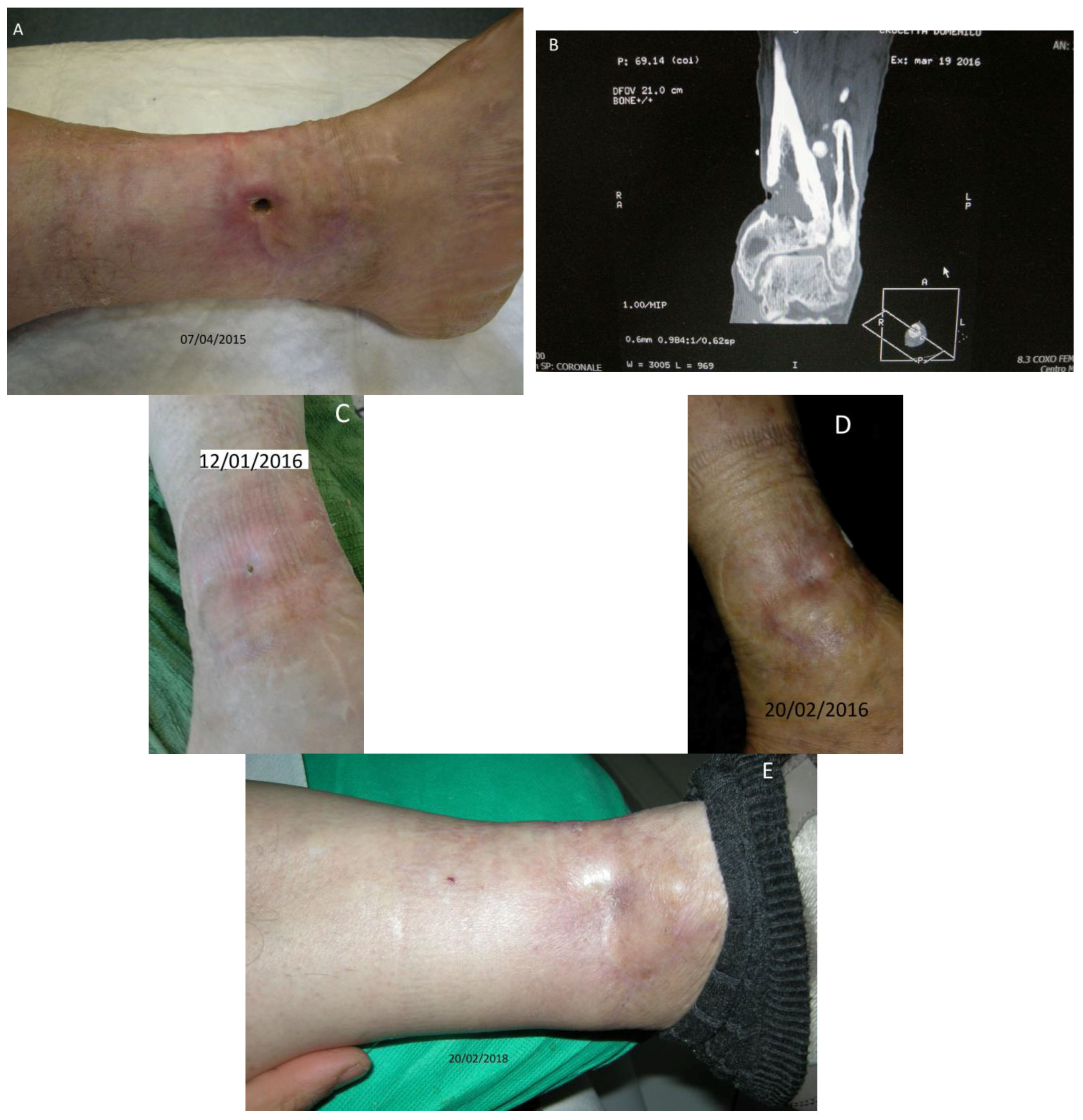 Diseases 06 00030 g001