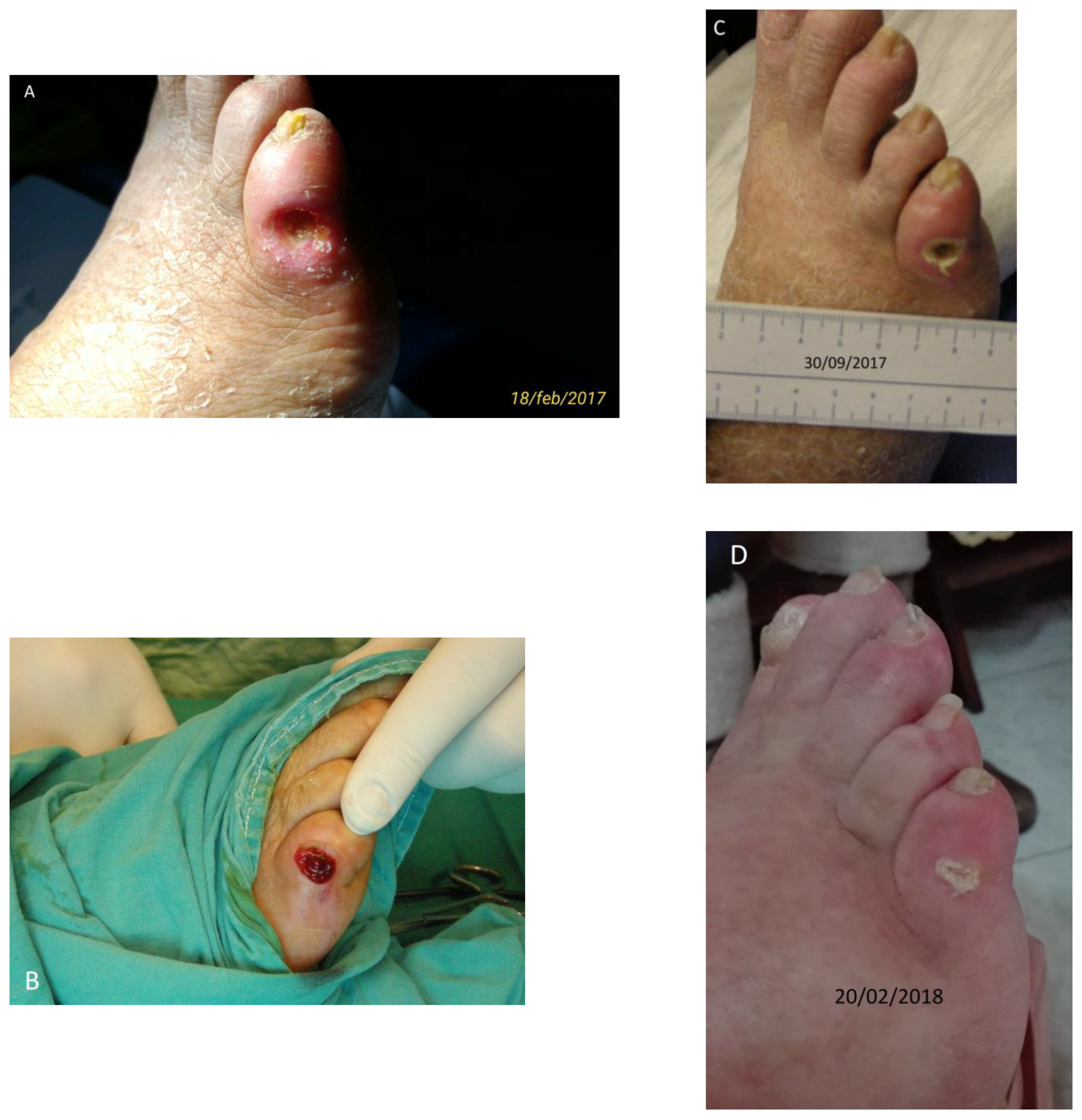 Diseases 06 00030 g002