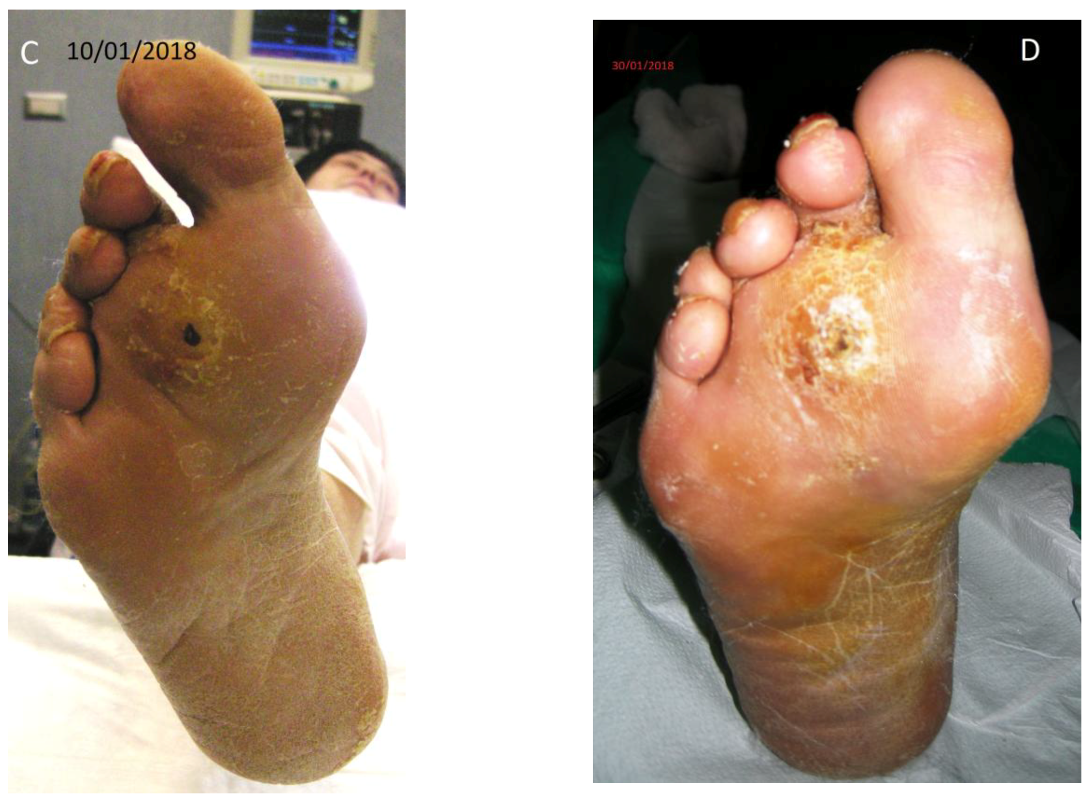 Diseases 06 00030 g003b