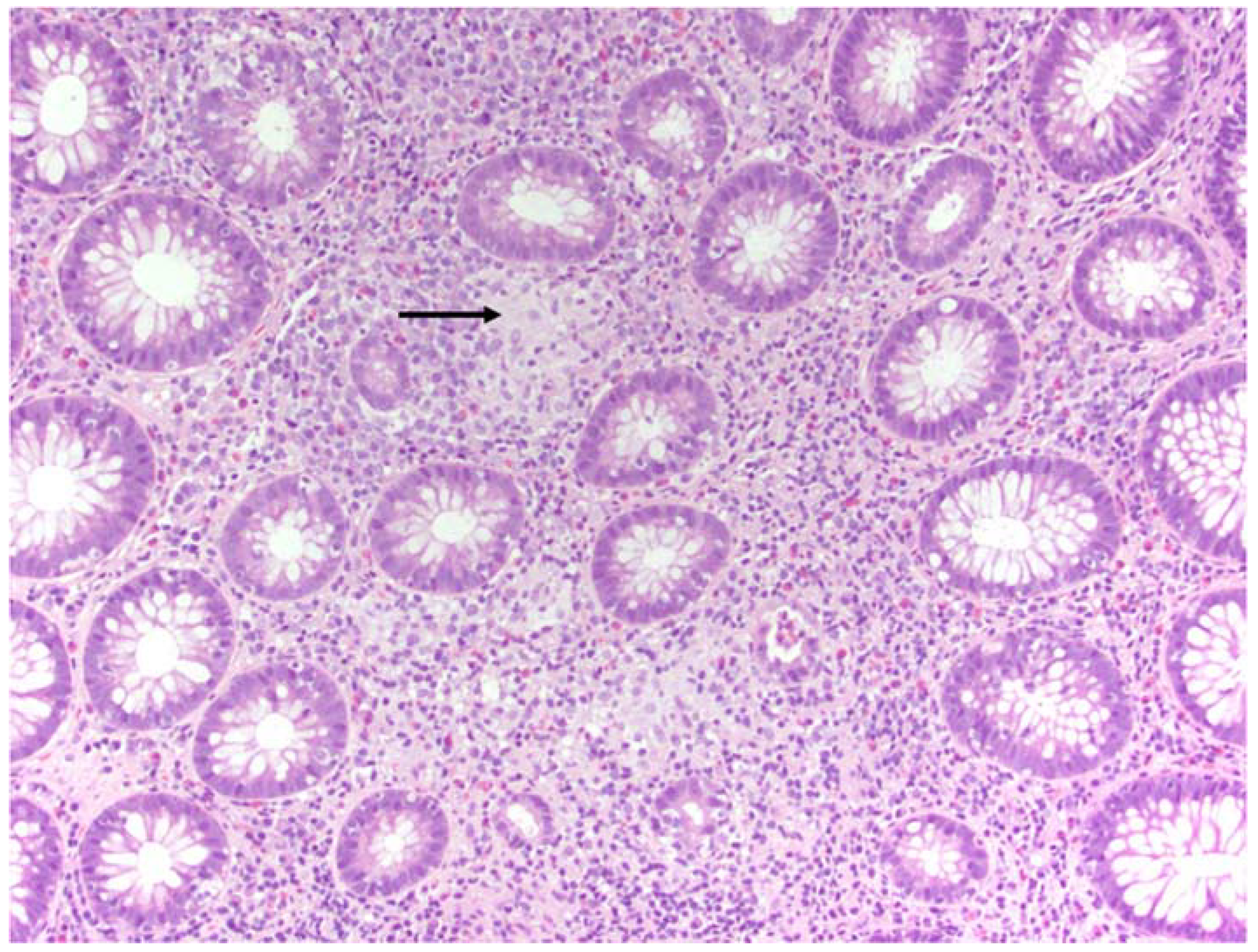 Diseases 06 00036 g002