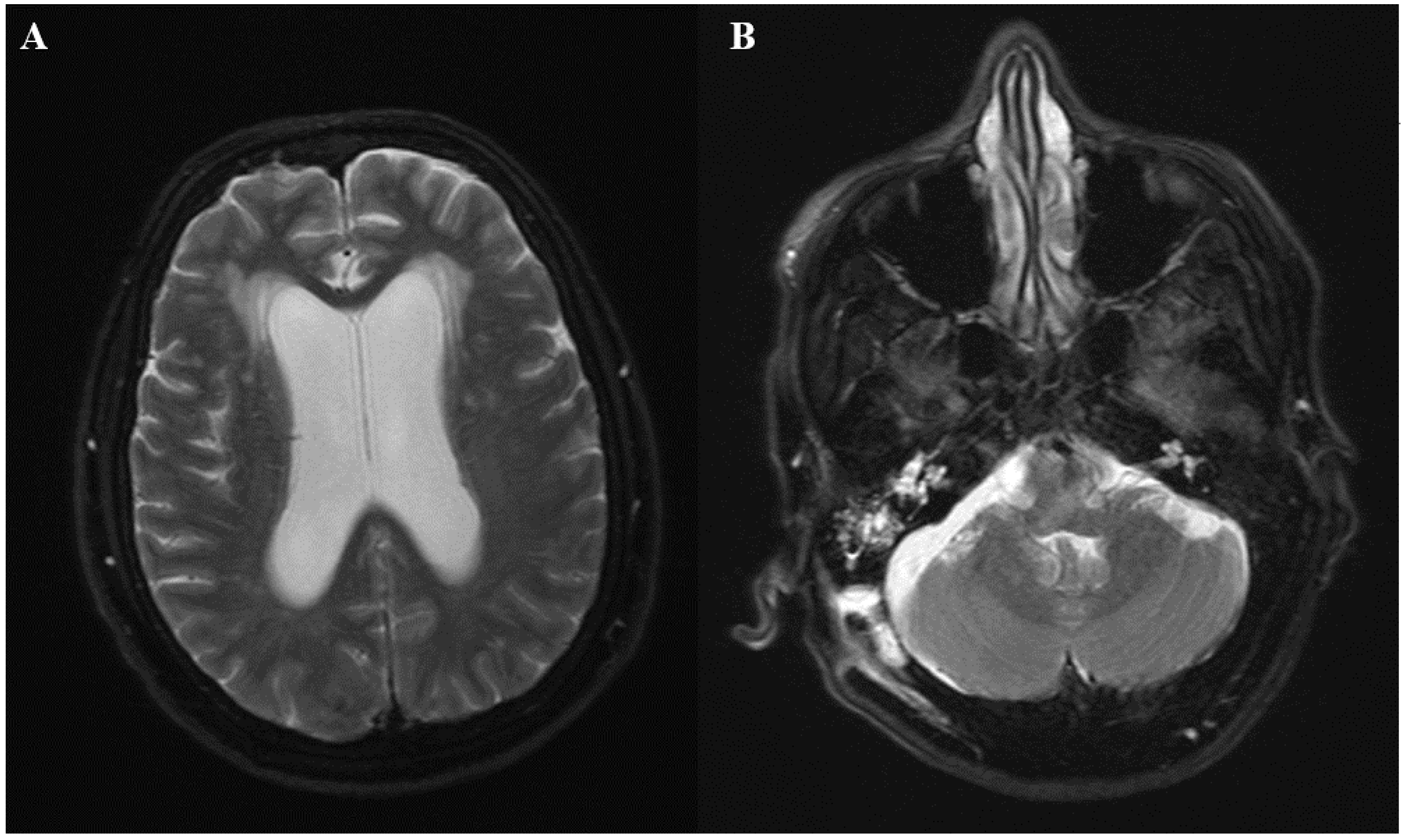 Diseases 06 00046 g001