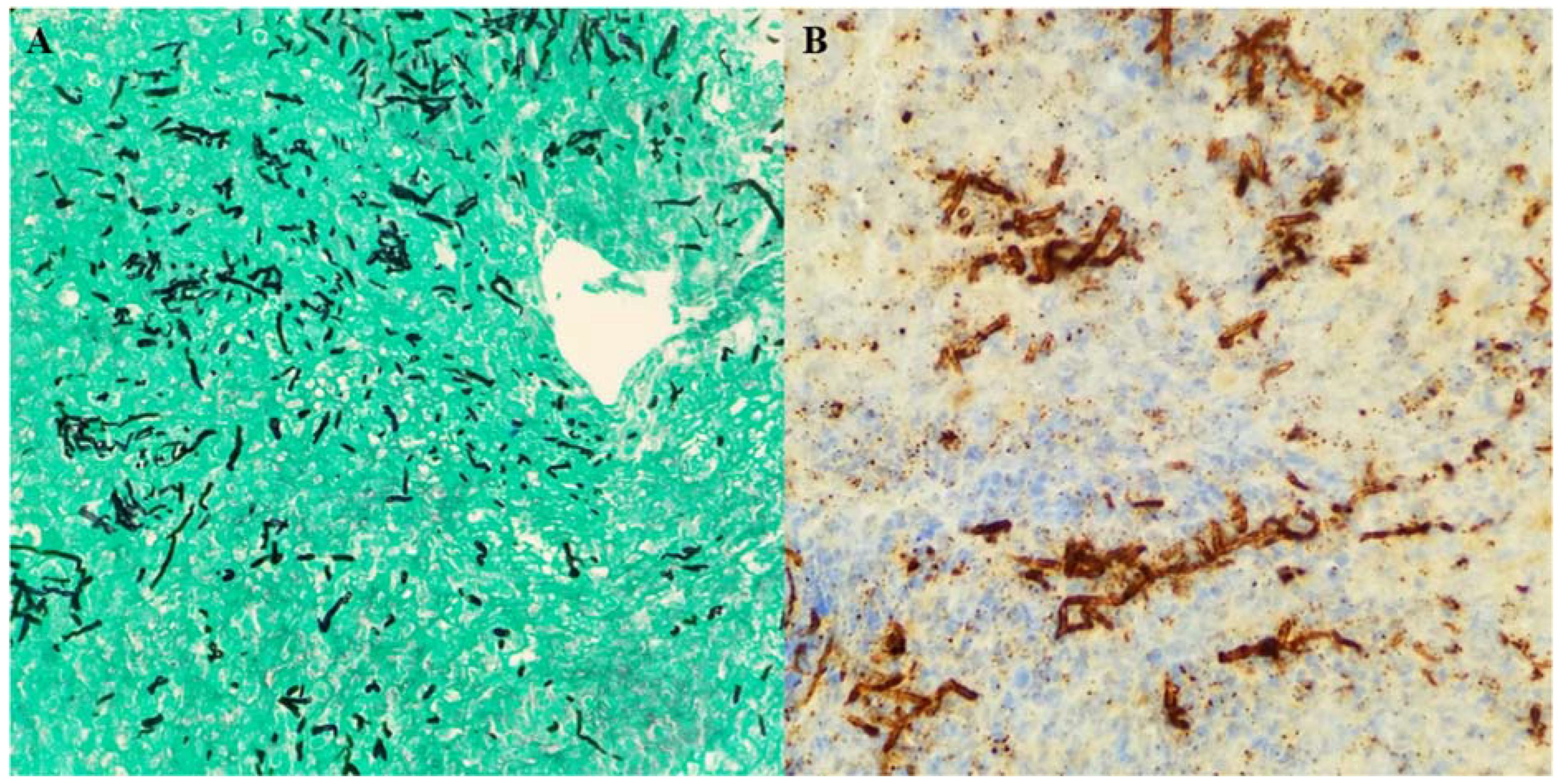 Diseases 06 00046 g002