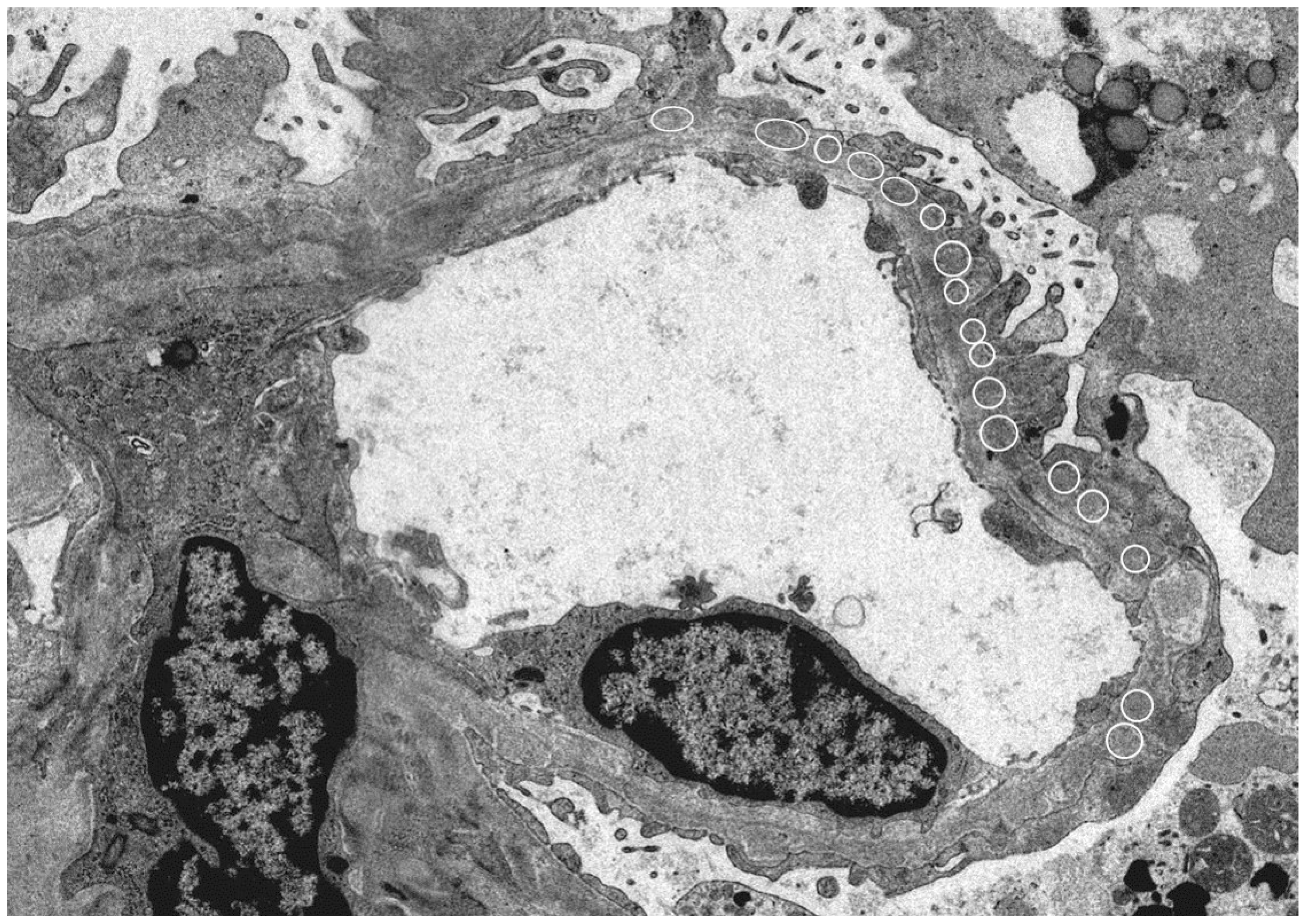 Diseases 06 00052 g001