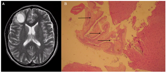 Diseases 06 00054 g001 550