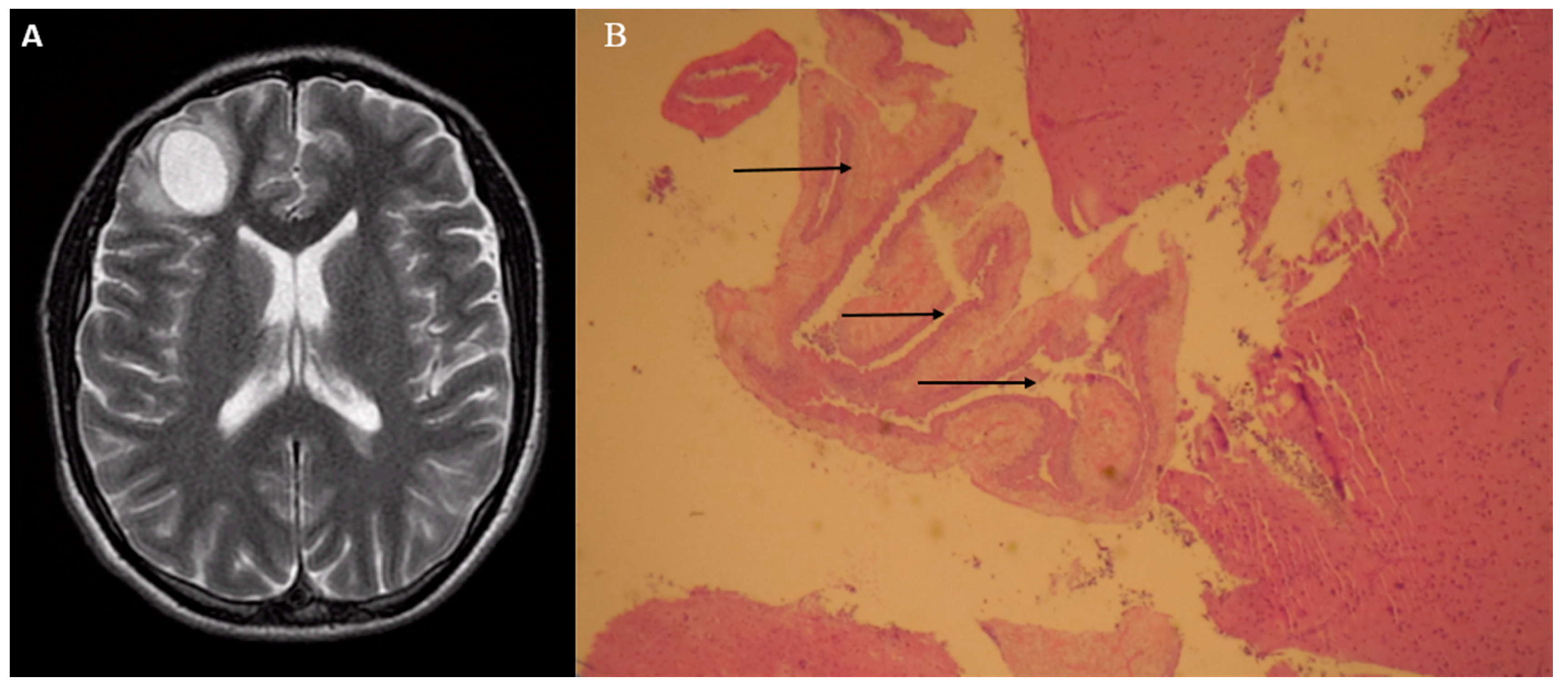 Diseases 06 00054 g001