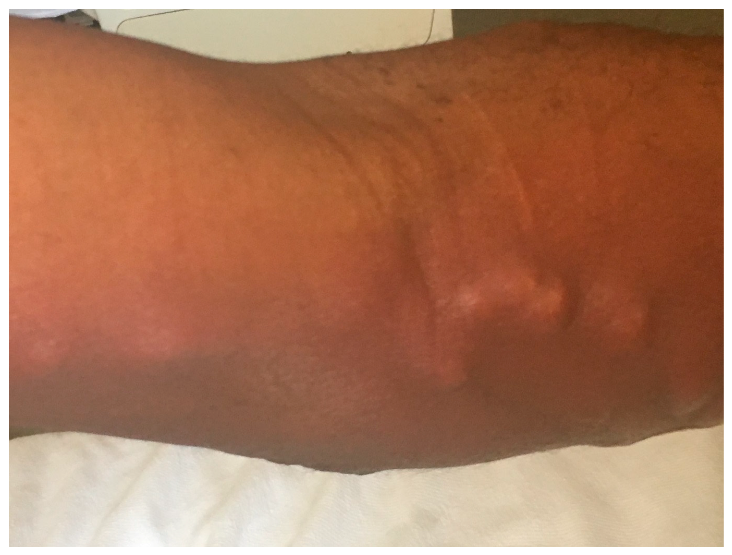 Diseases 06 00068 g001