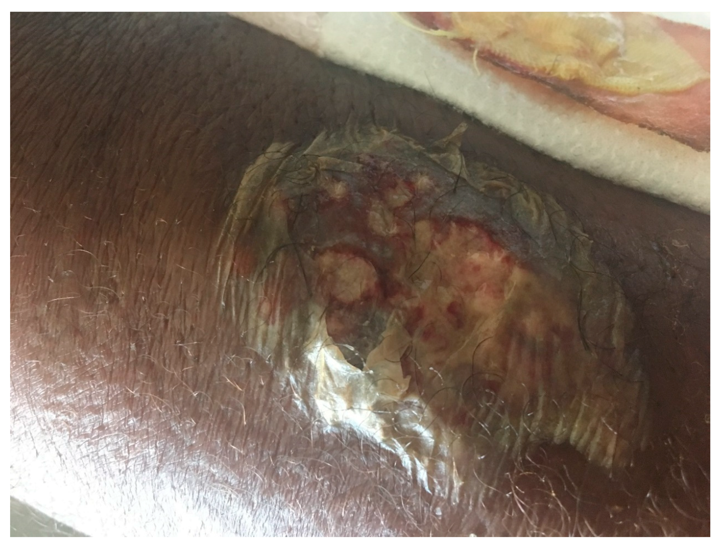 Diseases 06 00068 g002