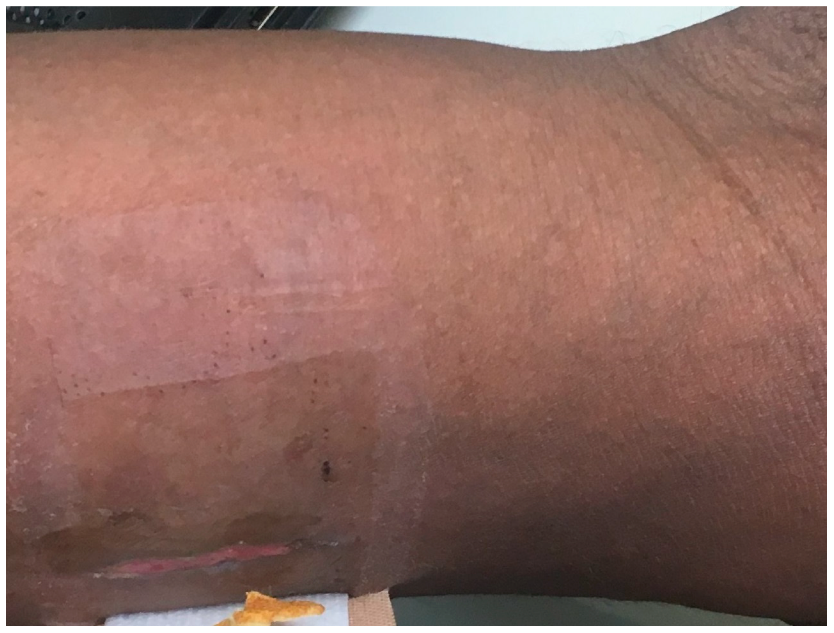 Diseases 06 00068 g004