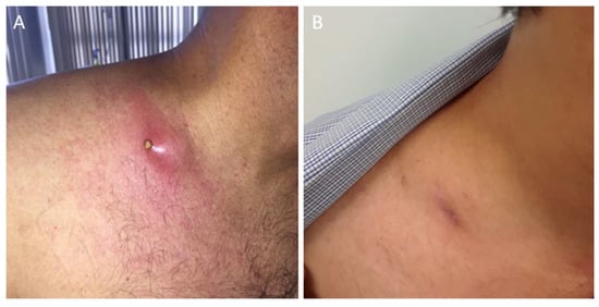 Diseases 06 00070 g001a 550