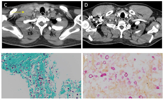 Diseases 06 00070 g001b 550
