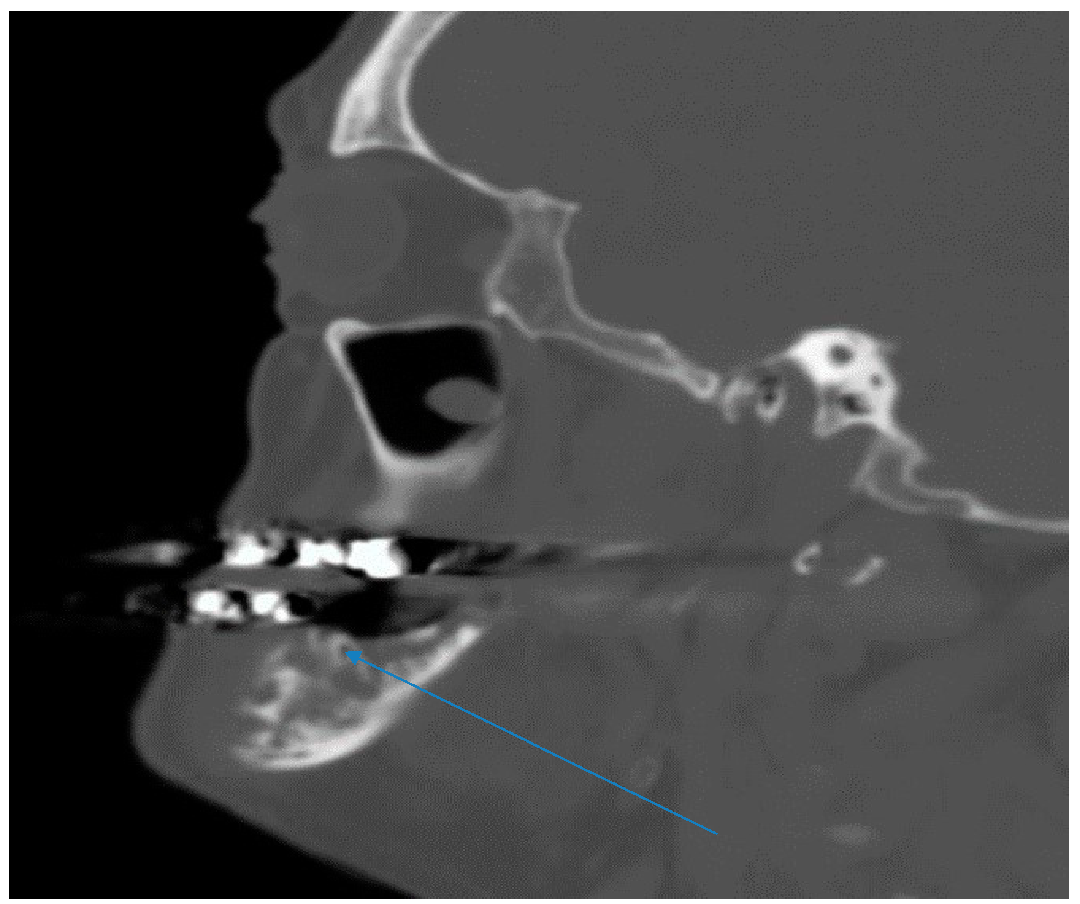 Diseases 06 00079 g002