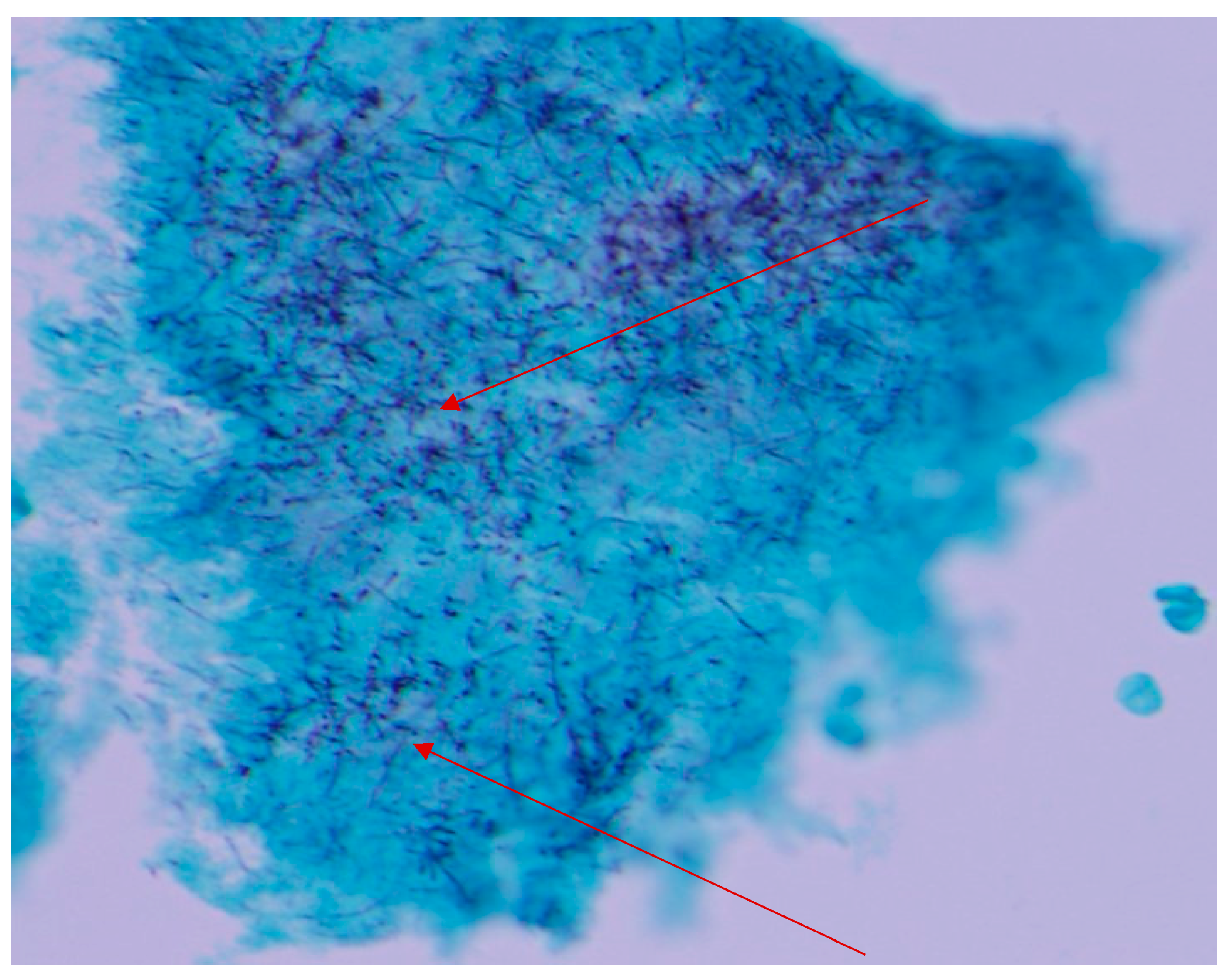 Diseases 06 00079 g005