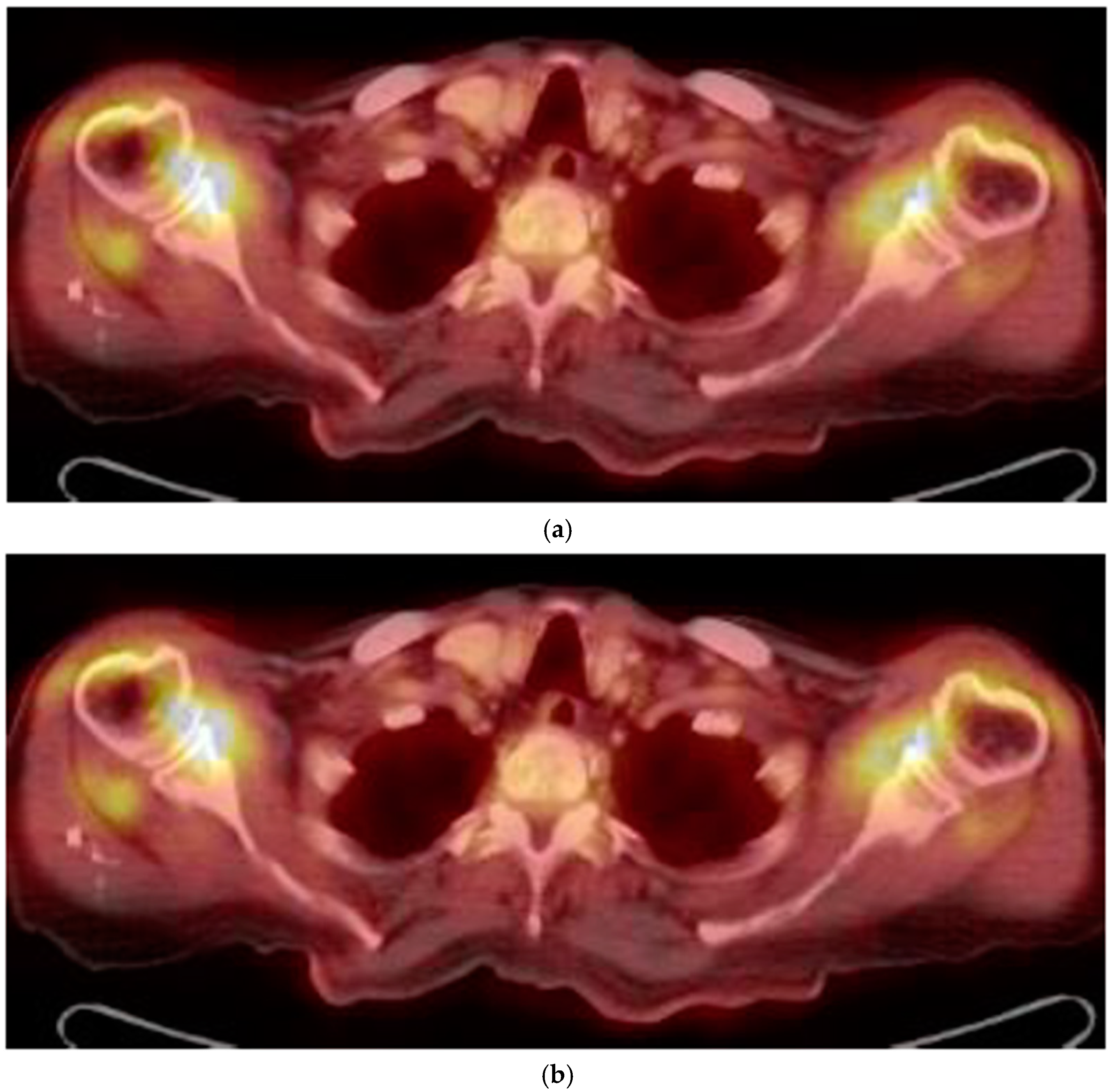 Diseases 06 00084 g002 Diseases 06 00084 g002
