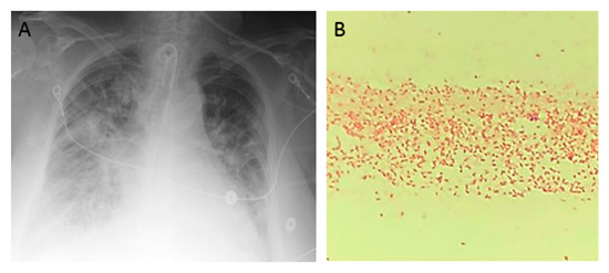 Diseases 06 00094 g001a