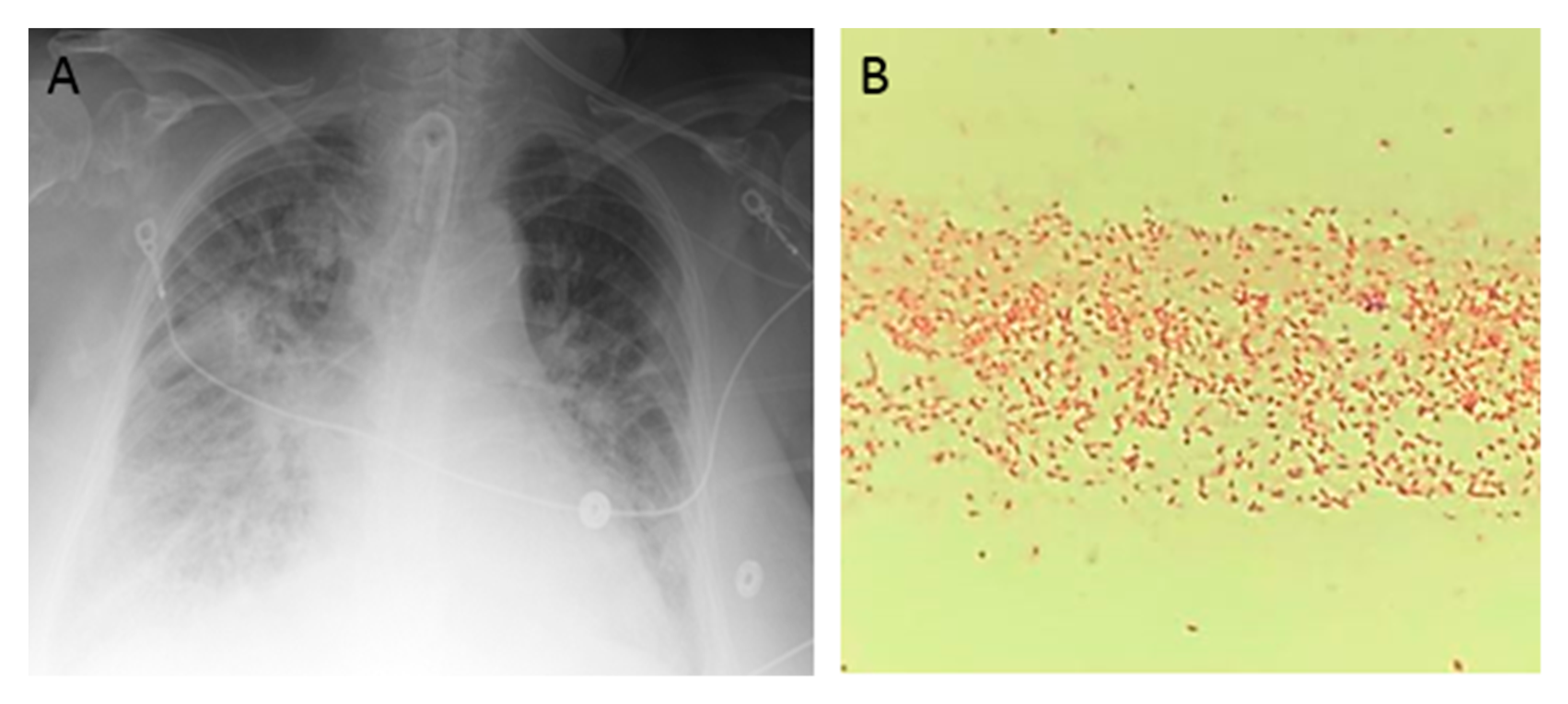 Diseases 06 00094 g001a Diseases 06 00094 g001a