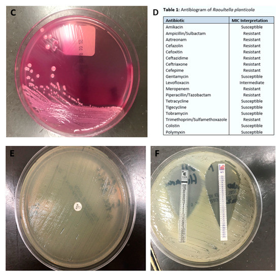 Diseases 06 00094 g001b