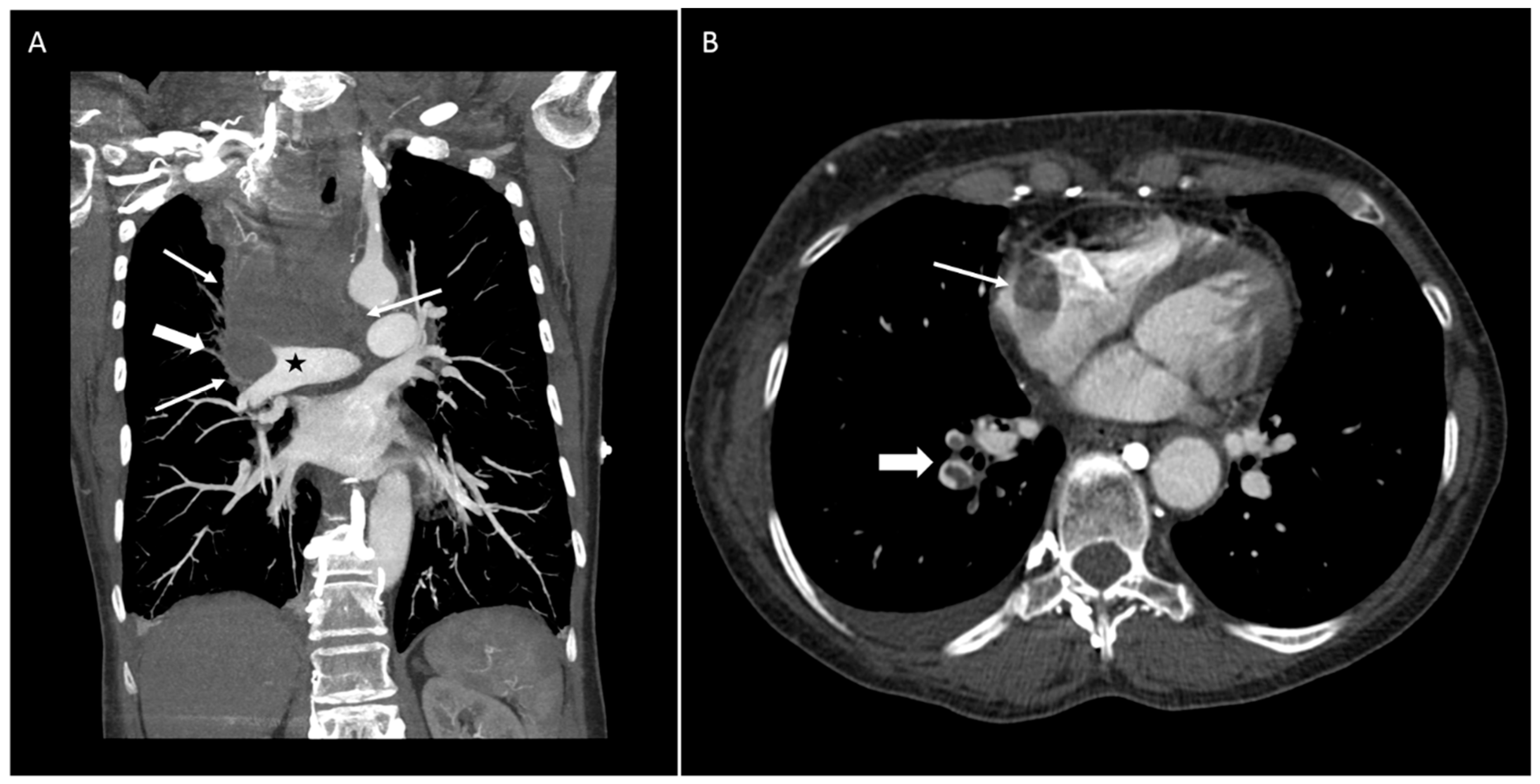 Diseases 06 00108 g001
