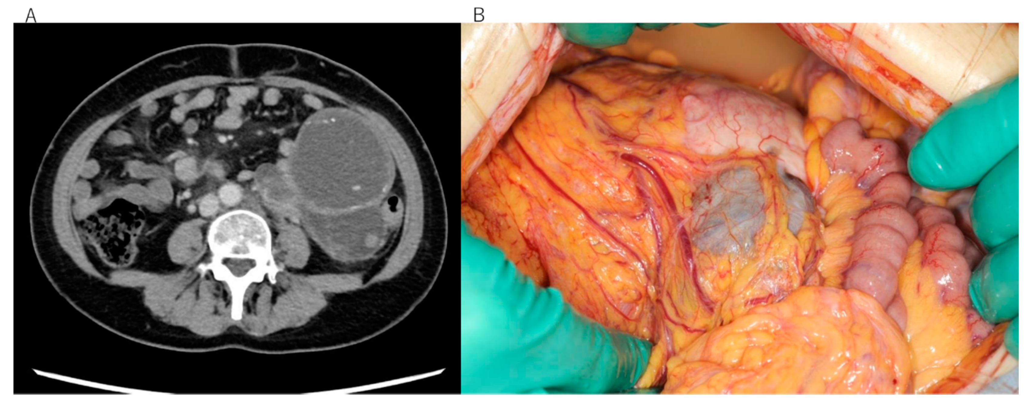Diseases 09 00014 g001a