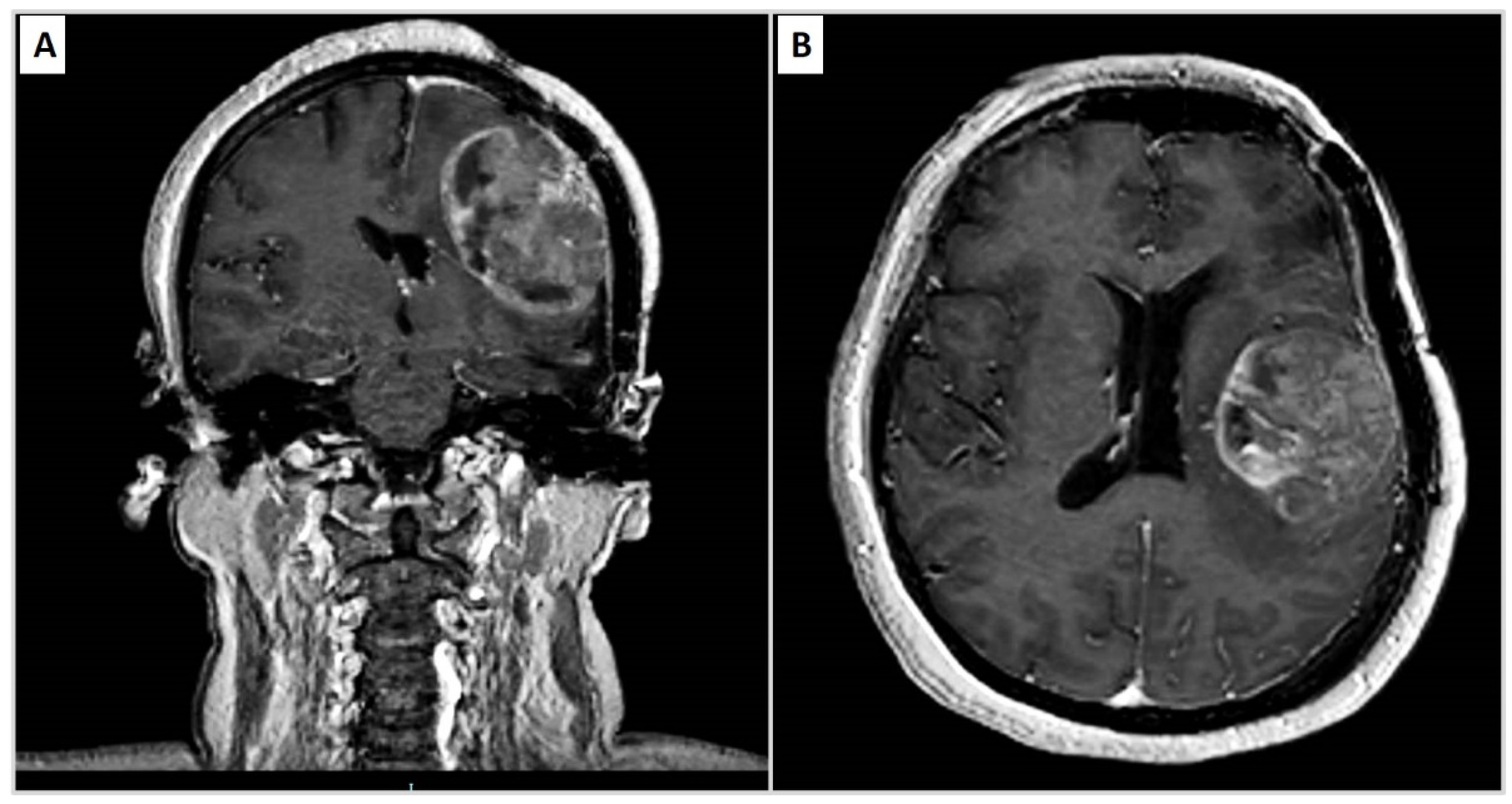 Diseases 09 00063 g001a