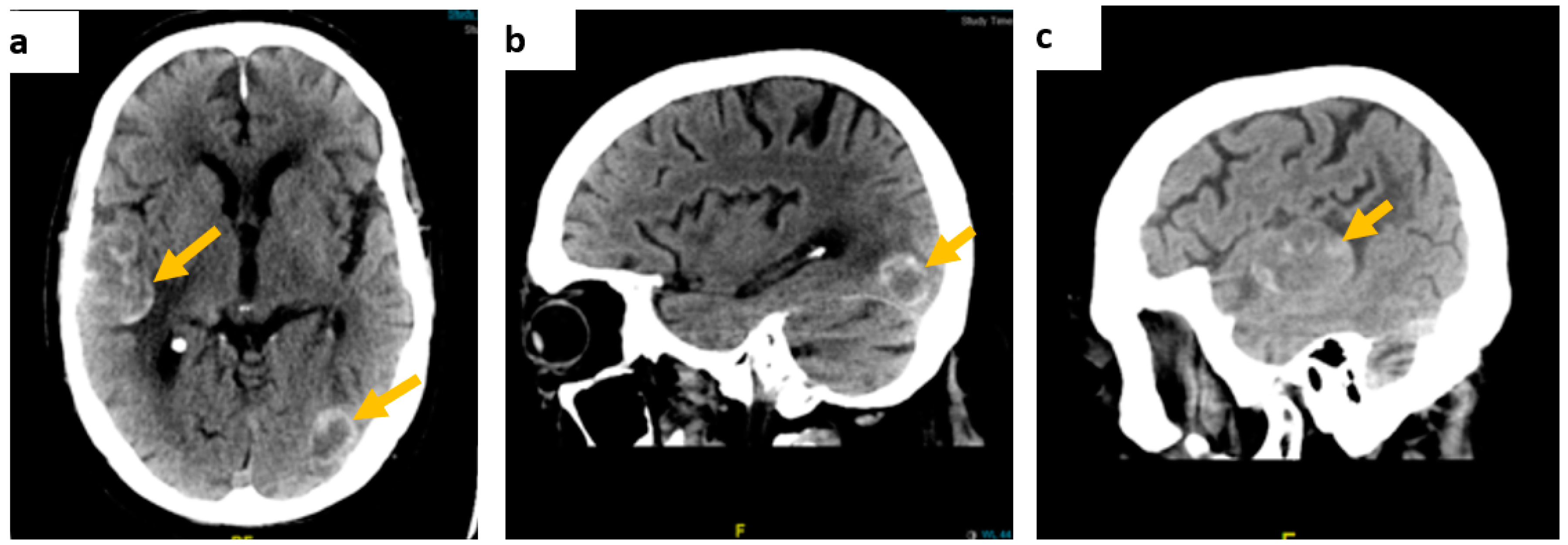 Diseases 10 00021 g001