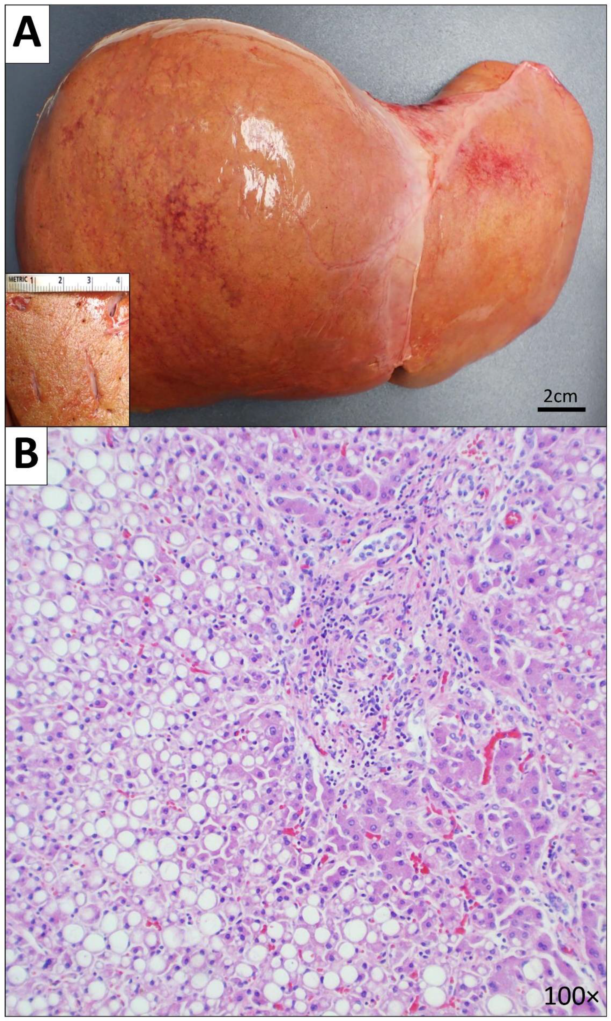 Diseases 10 00054 g004