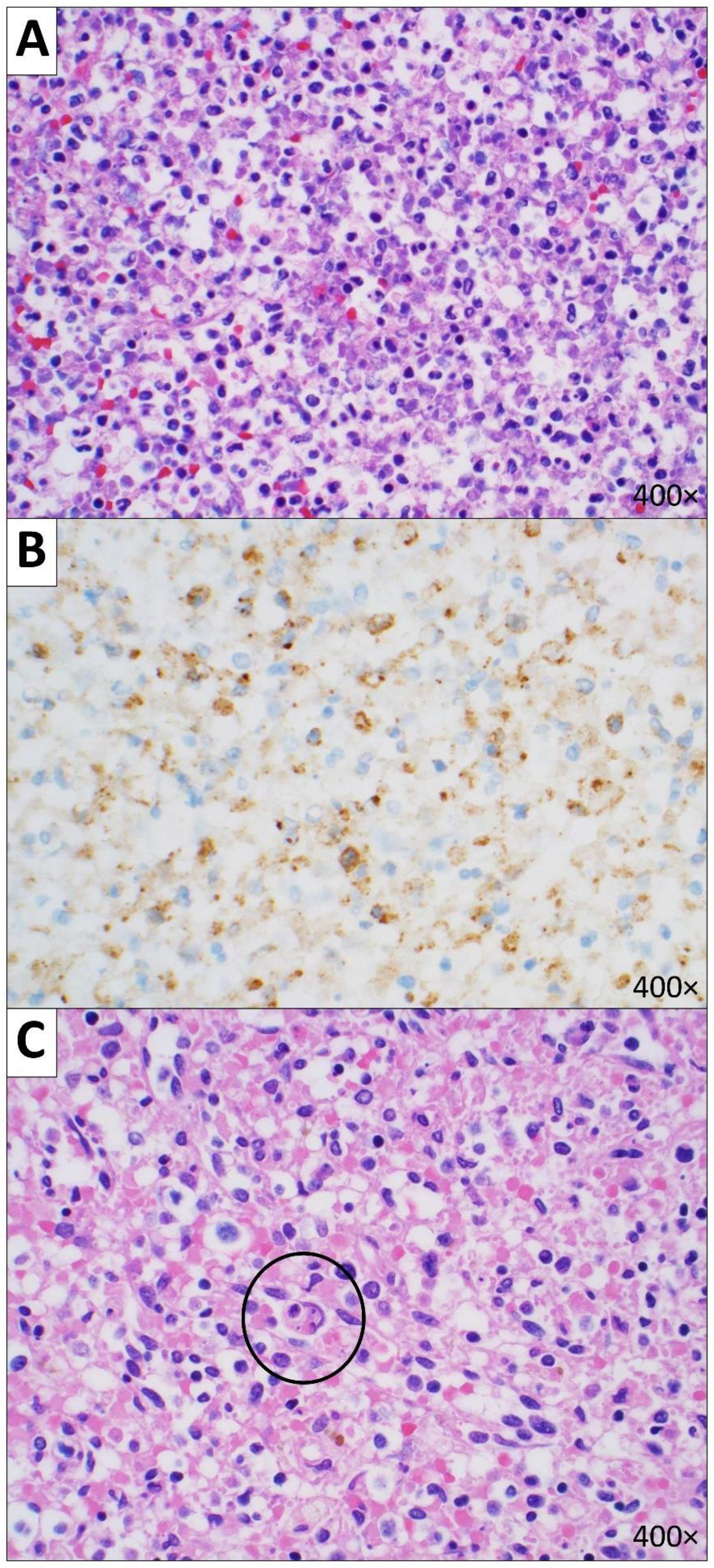 Diseases 10 00054 g005