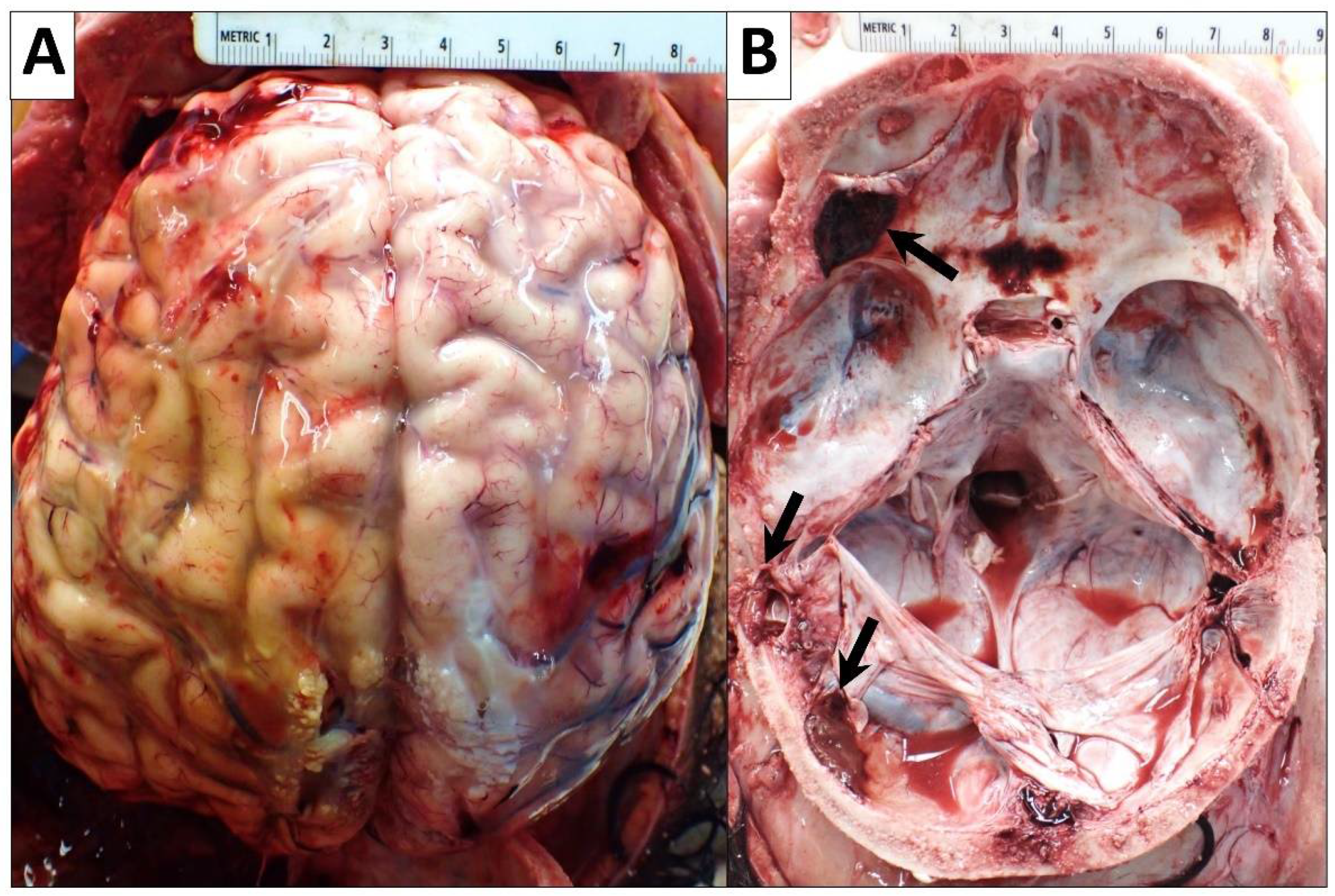 Diseases 10 00054 g007