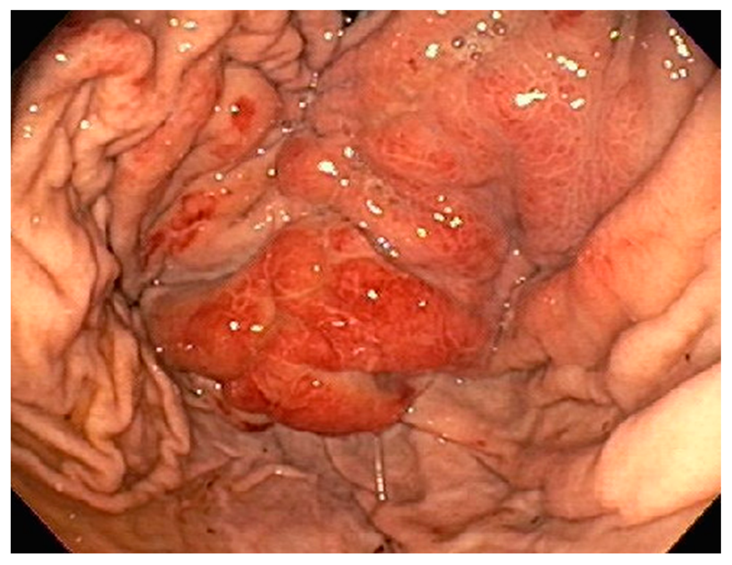 Diseases 10 00061 g002