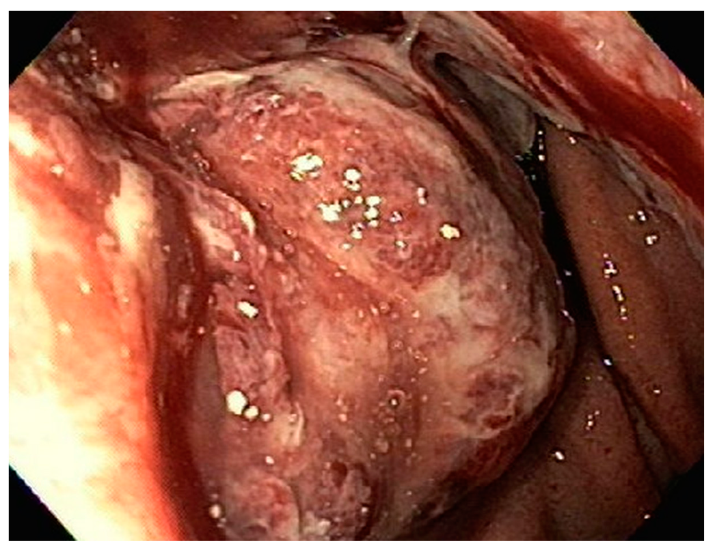 Diseases 10 00061 g011