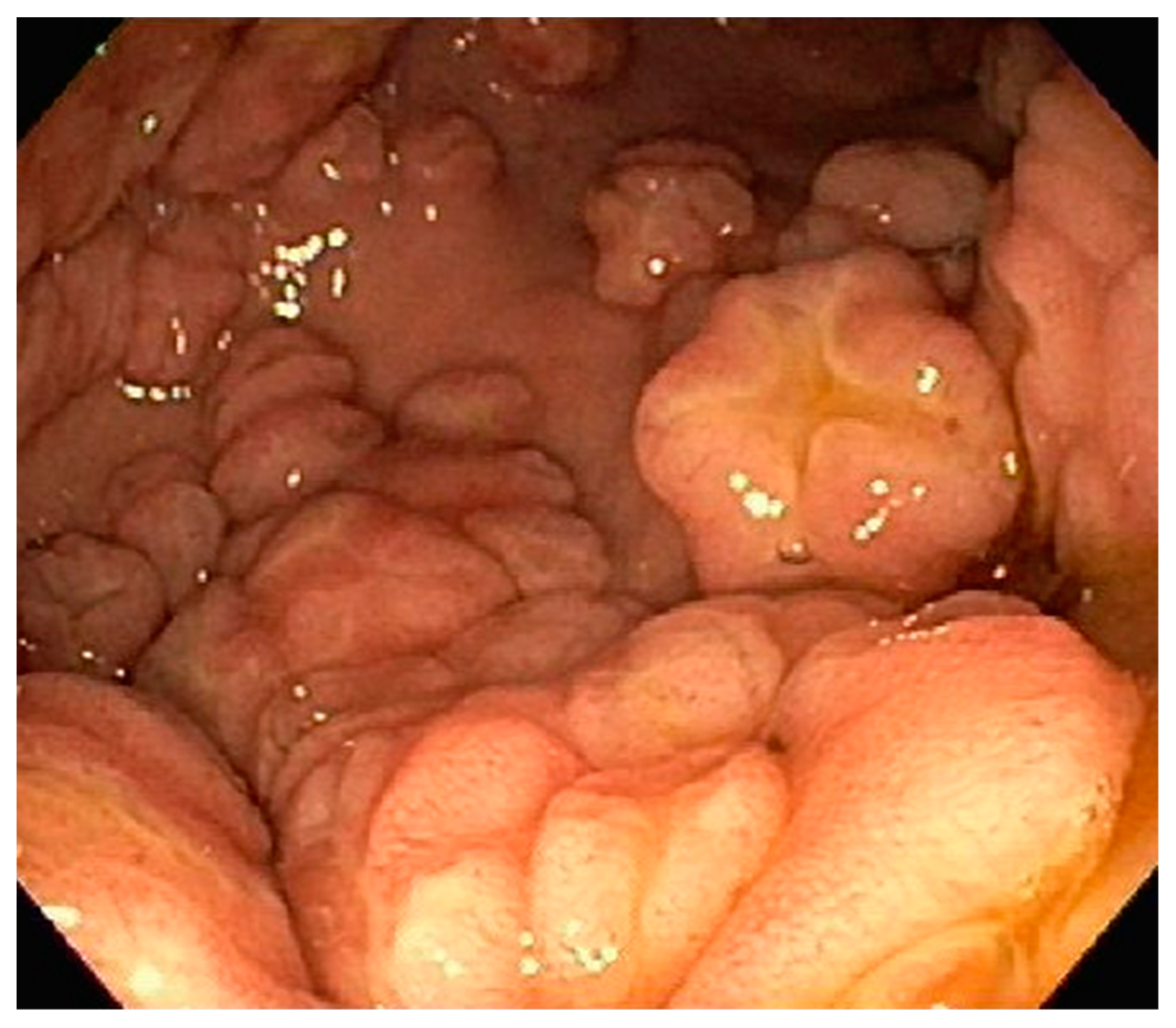 Diseases 10 00061 g015