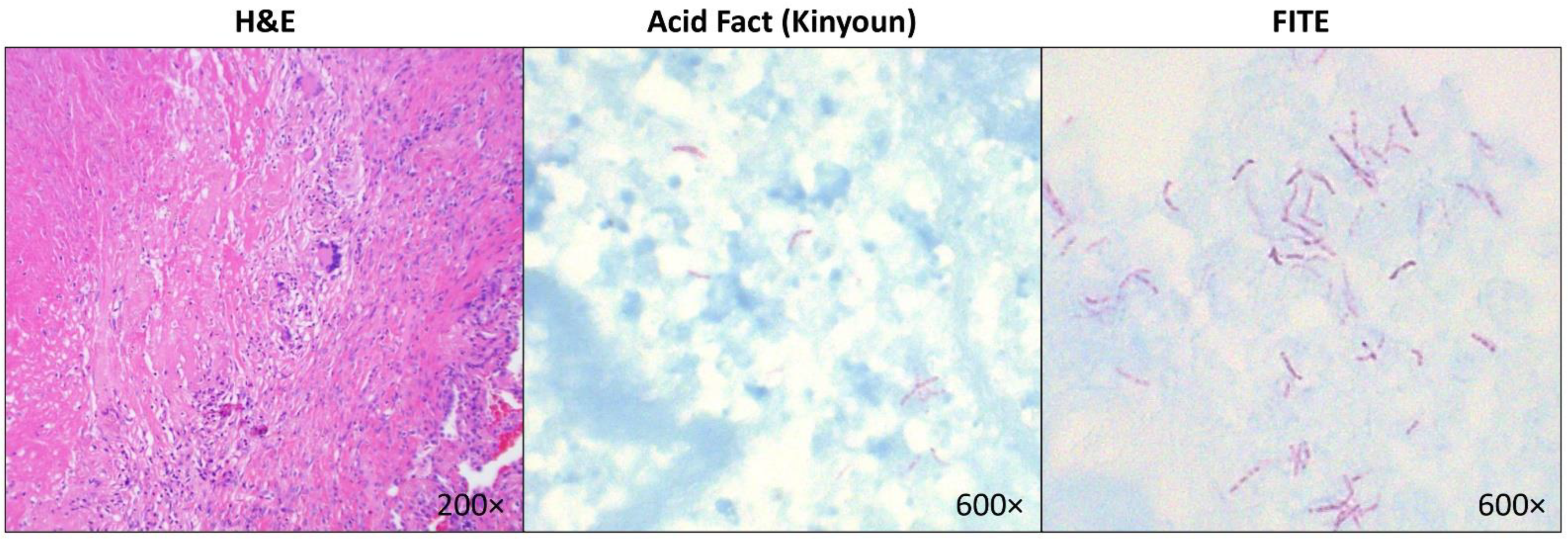 Diseases 10 00096 g001